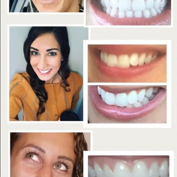 THE BEST Whitening Toothpaste!  NO HARSH CHEMICALS - Picture 12 of 12